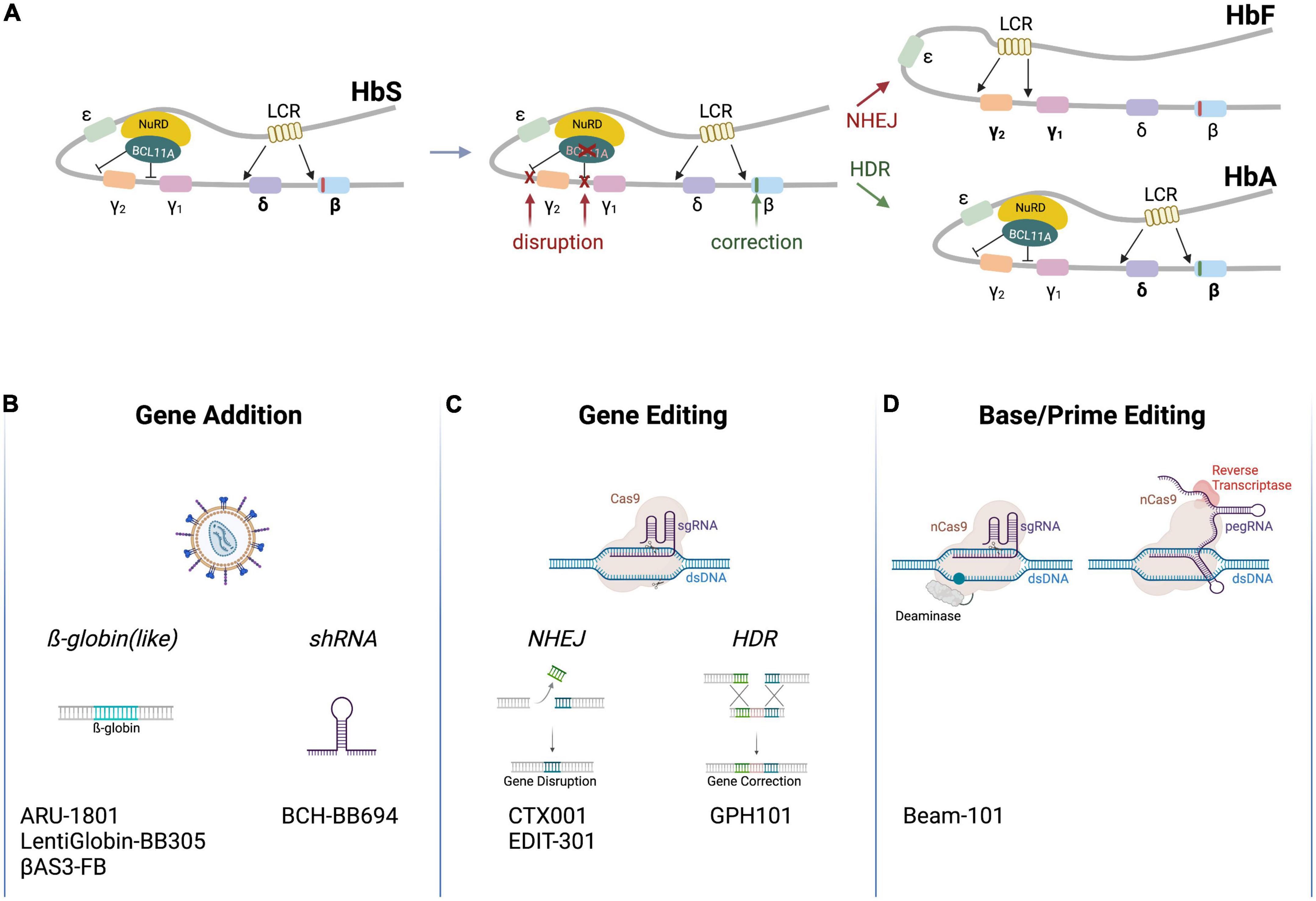 Clinical genome editing to treat sickle cell disease—A brief update